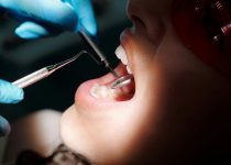 maintain clean tear free screens