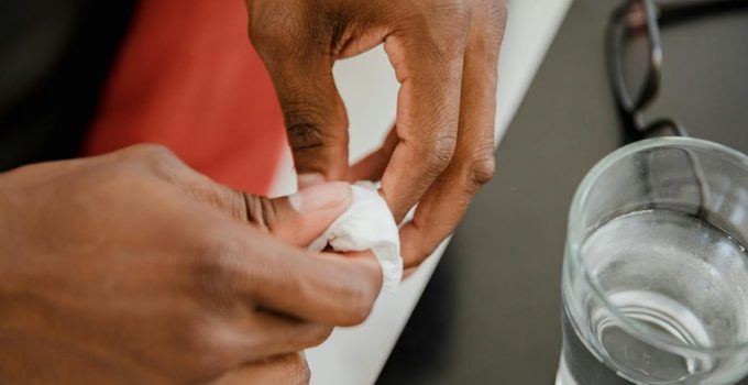 protect grills from damage